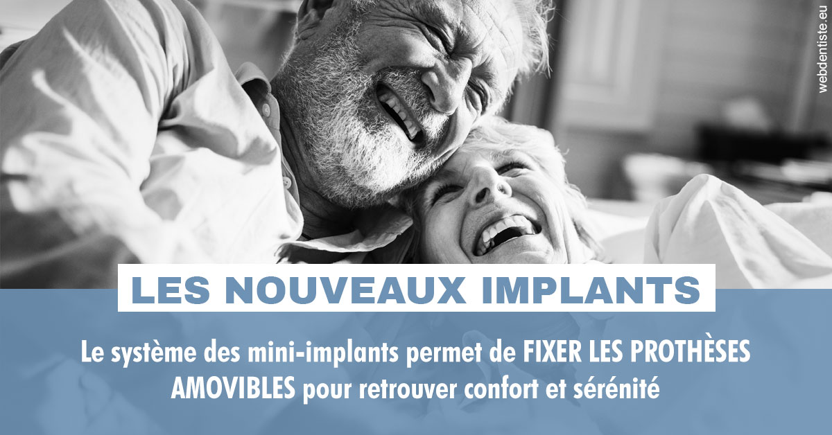 https://dr-gaillard-frederique.chirurgiens-dentistes.fr/Les nouveaux implants 2