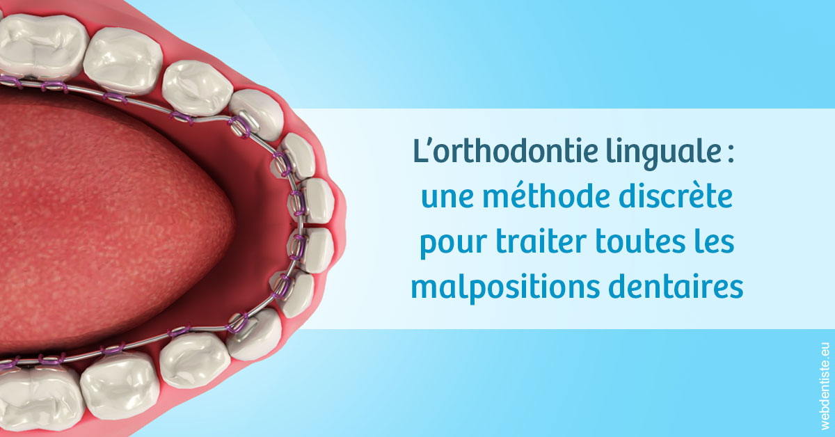 https://dr-gaillard-frederique.chirurgiens-dentistes.fr/L'orthodontie linguale 1