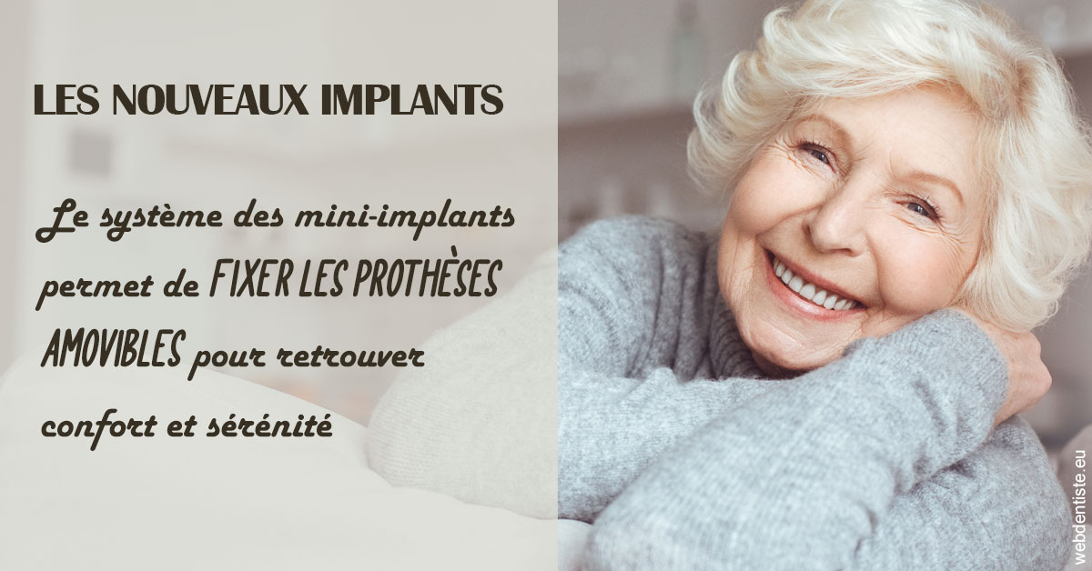 https://dr-gaillard-frederique.chirurgiens-dentistes.fr/Les nouveaux implants 1