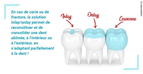 https://dr-gaillard-frederique.chirurgiens-dentistes.fr/L'INLAY ou l'ONLAY