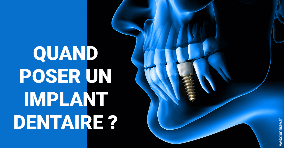 https://dr-gaillard-frederique.chirurgiens-dentistes.fr/Les implants 1