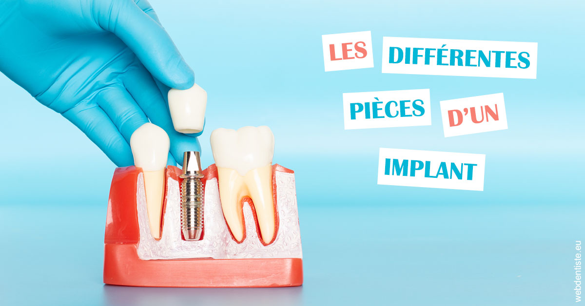 https://dr-gaillard-frederique.chirurgiens-dentistes.fr/Les différentes pièces d’un implant 2