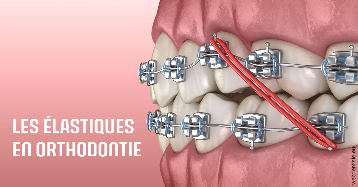 https://dr-gaillard-frederique.chirurgiens-dentistes.fr/Elastiques orthodontie 2