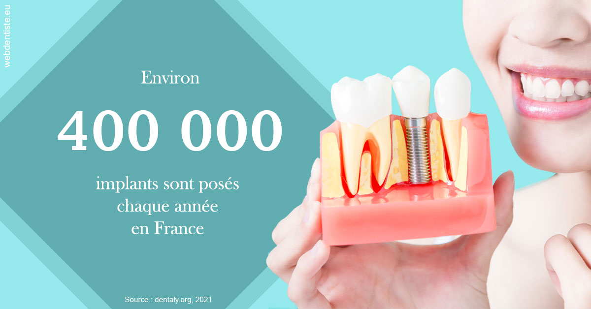 https://dr-gaillard-frederique.chirurgiens-dentistes.fr/Pose d'implants en France 2
